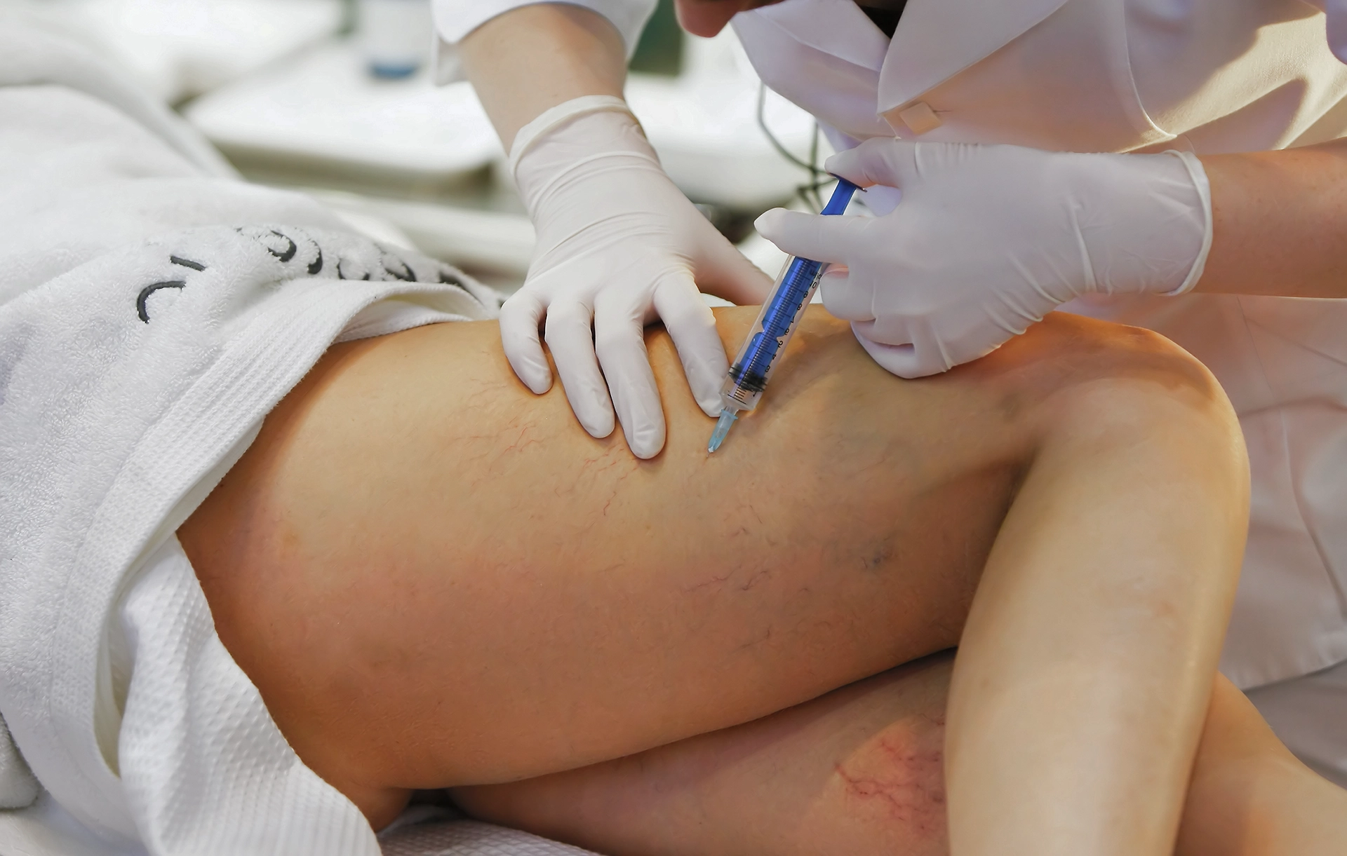 Köpük Tedavisi İle Varis Geçer Mi? 15 varis-kopuk-tedavisi